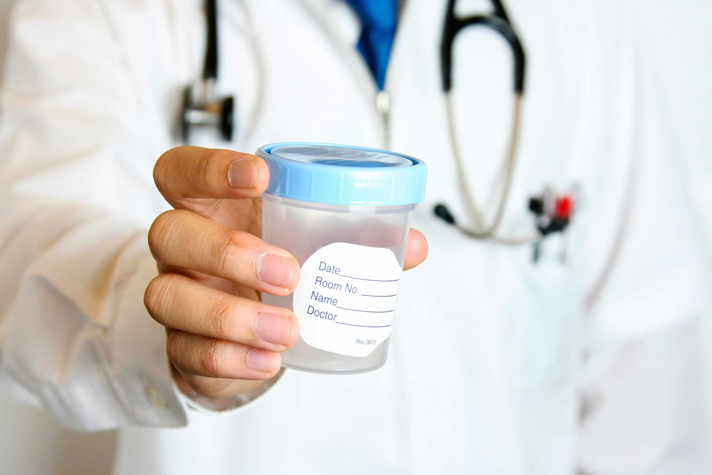 13 things bladder pee isn't sterile