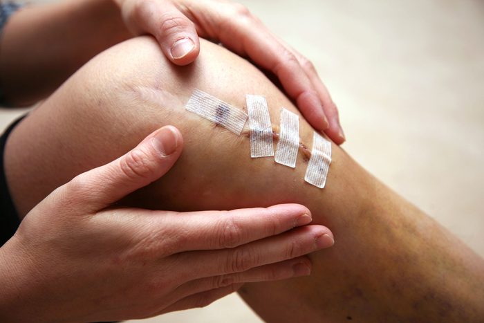 person with bandaged knee