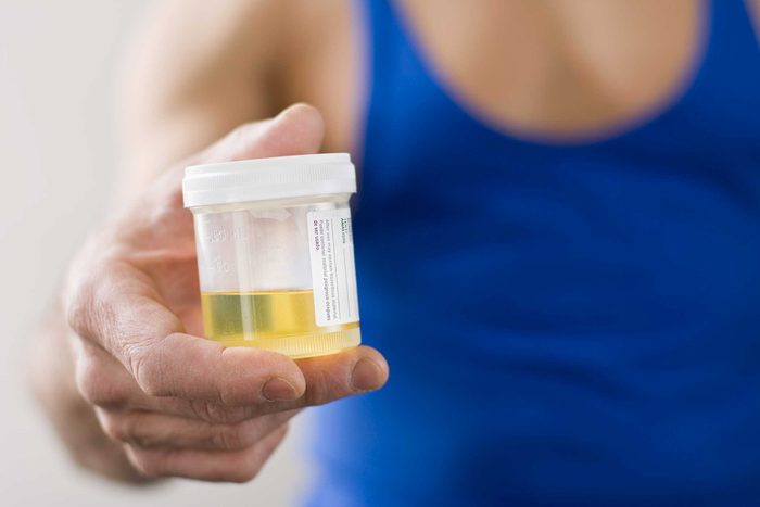 person holding urine sample