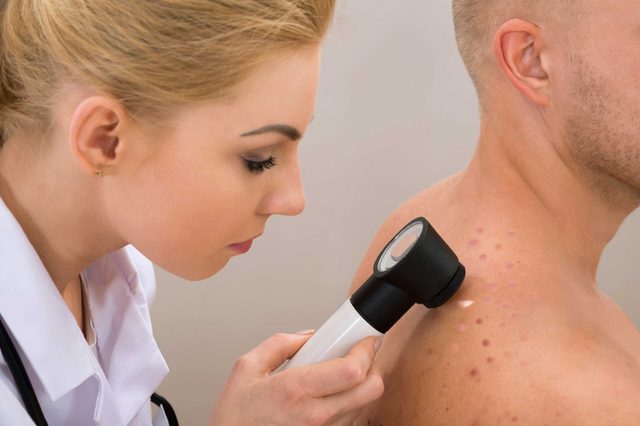 03-get-skincare-rules-freckles
