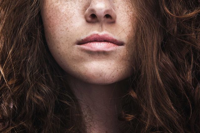 07-embrace-skincare-rules-freckles
