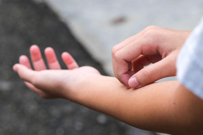 person scratching their forearm