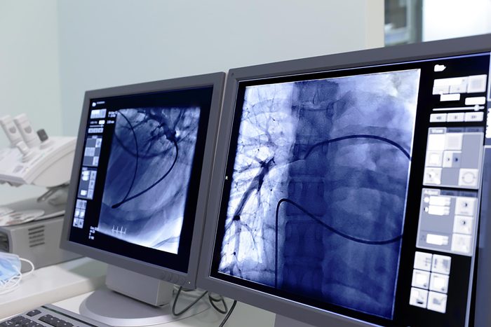 monitor showing heart scan