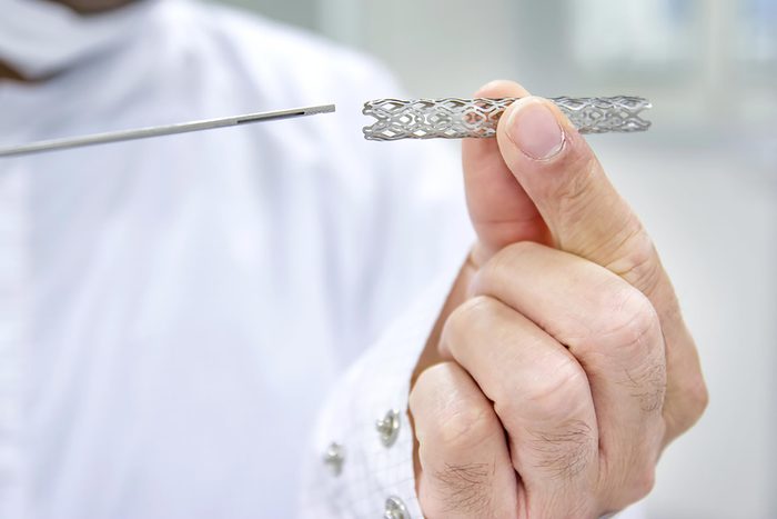 doctor holding stent