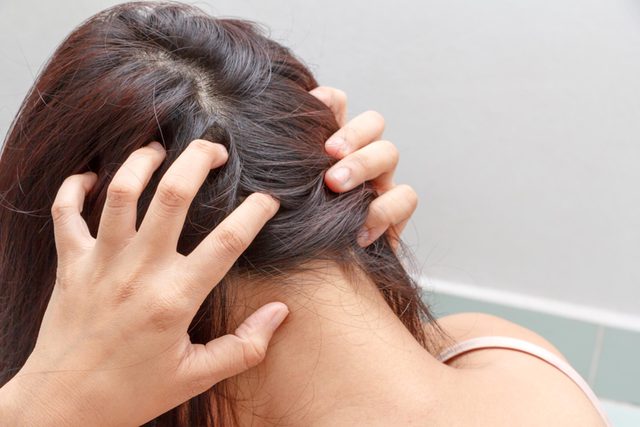 scalp