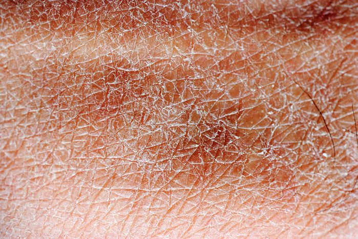 skin