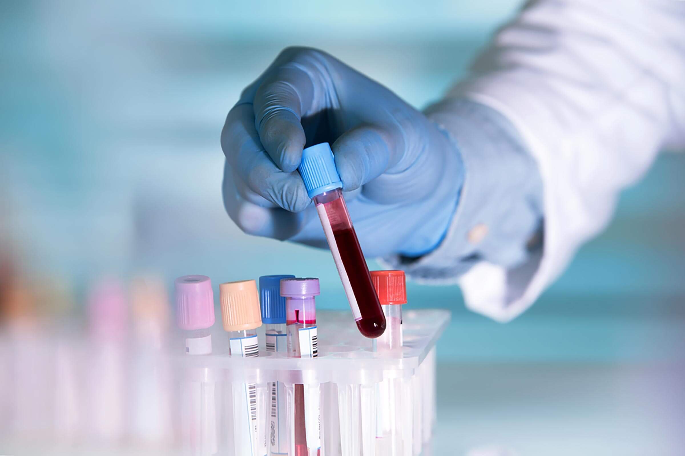 blood test