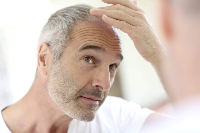 Man checking his receding hairline in the mirror.