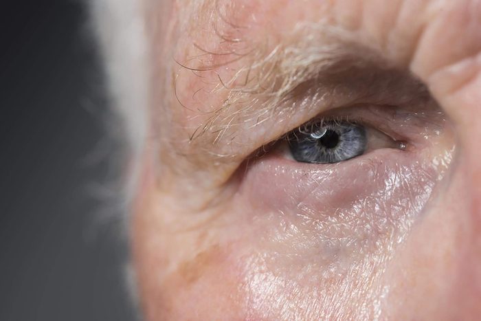 Eye