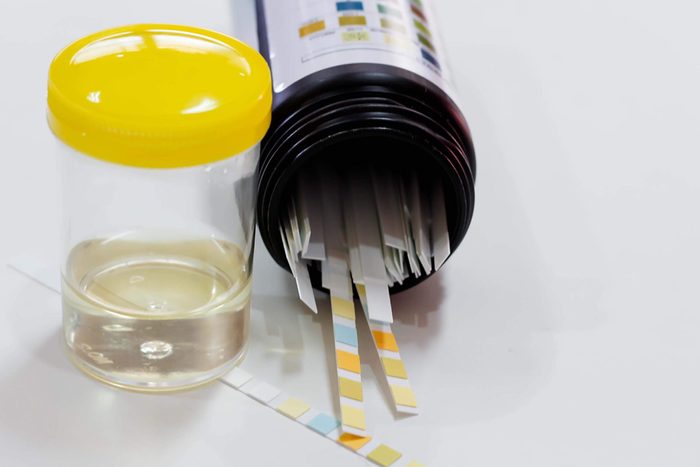 Urine-test