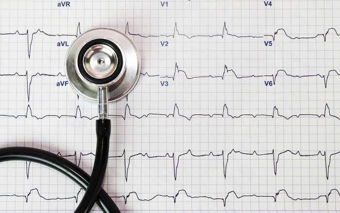 Stethoscope