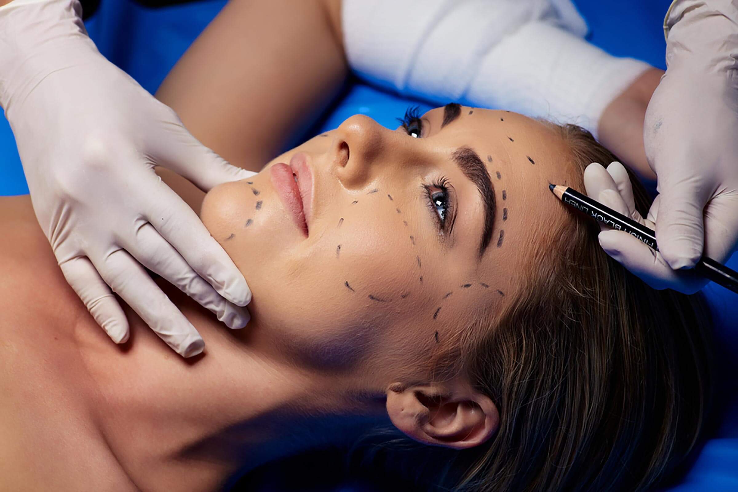 woman in surgery room getting lines for surgery