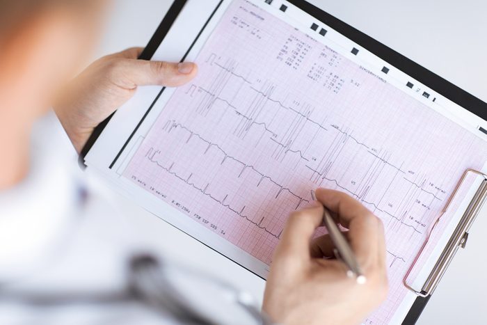bright picture of male doctor hands with cardiogram