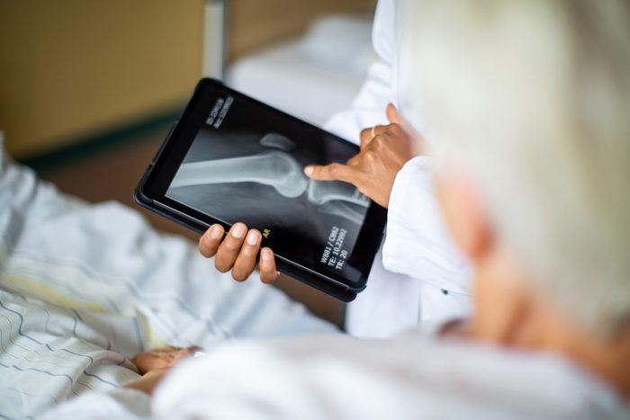 doctor showing patient knee scan results for surgery