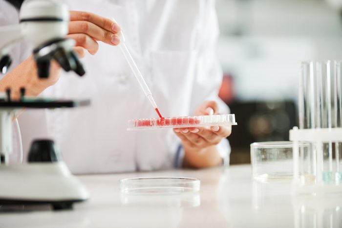 bloodwork in lab