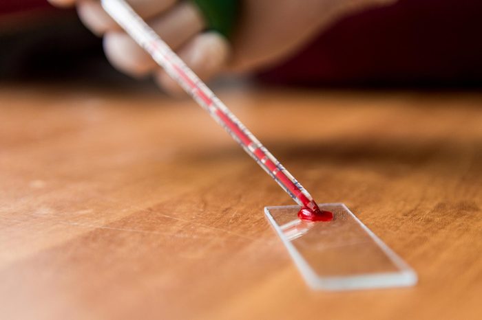 blood being smeared on glass for testing