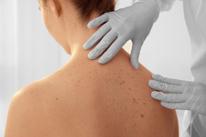 Dermatologist examining patient