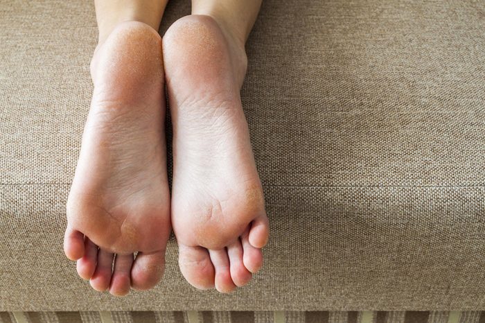 feet