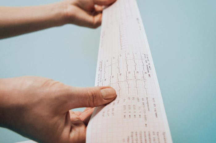 person holding a printout of a heart test