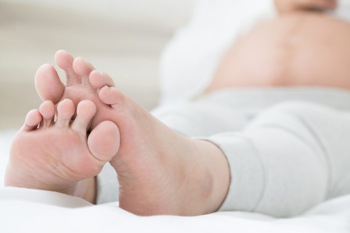 Pregnant woman with swollen feet
