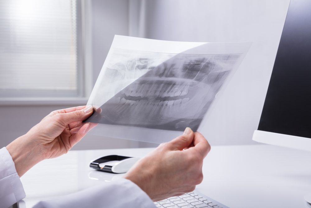 Close-up Of A Dentist's Hand Holding Teeth X-ray