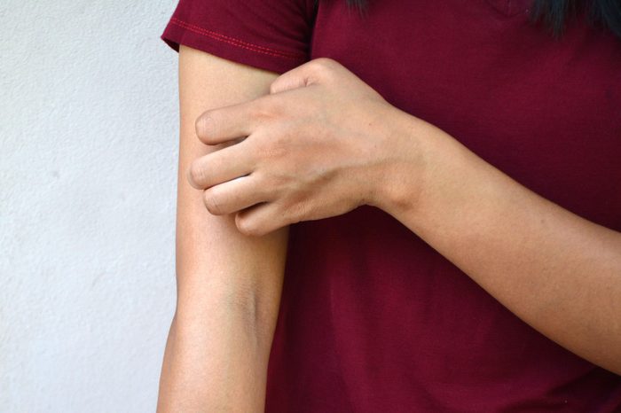 scratch arm