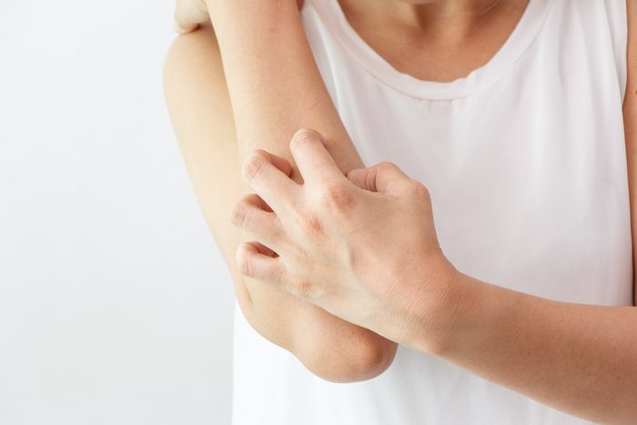 Women scratch the itch with hand / arm itching / Concept with Healthcare And Medicine.