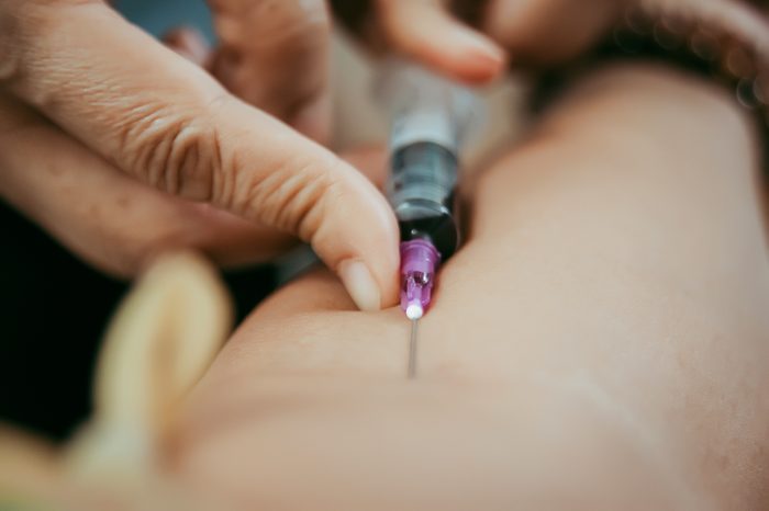 Close up pricking needle syringe in the arm blood sample for blood test.; Shutterstock ID 1096691849