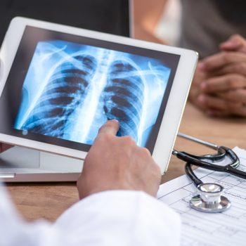 Doctor reading the scan lung on digital tablet screen.