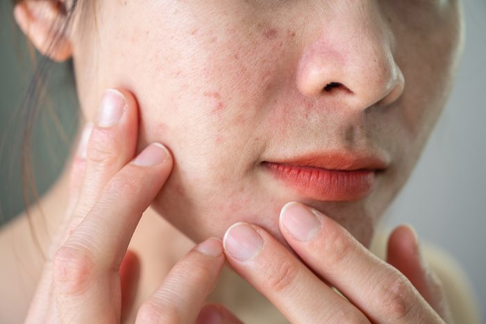 10 Silent Signs Stress Is Making You Sick Gettyimages 1469751146
