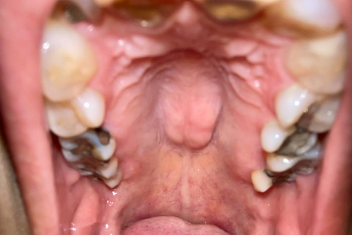 close up of roof of mouth